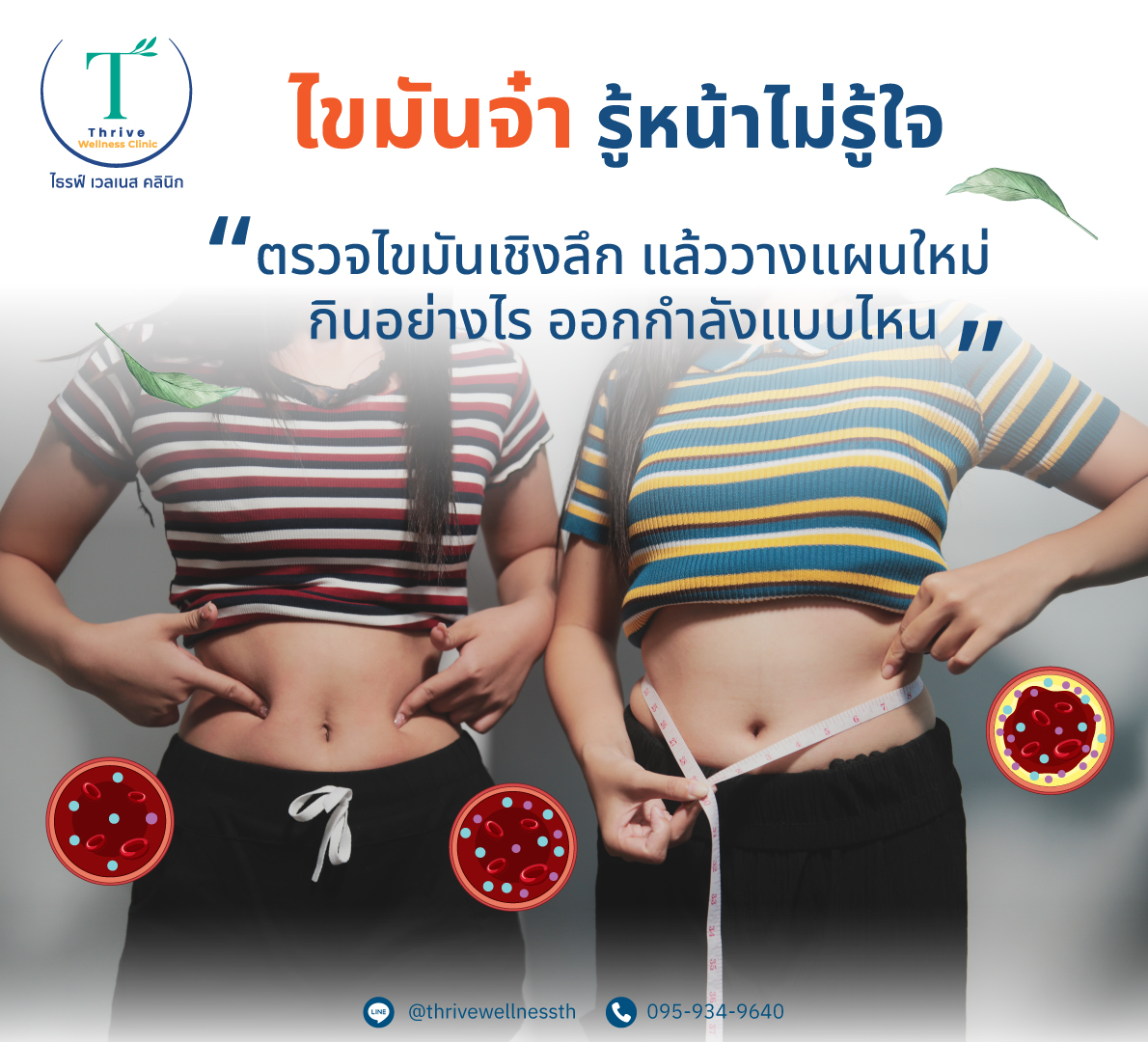 ไขมันจ๋า รู้หน้าไม่รู้ใจ — ตรวจไขมันเชิงลึก แล้ววางแผนใหม่ กินอย่างไร ออกกำลังแบบไหน Thrive Wellness Clinic